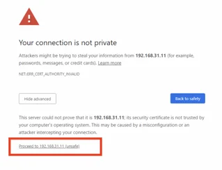 Local certificate warning with the option to proceed to 192.168.31.11 highlighted